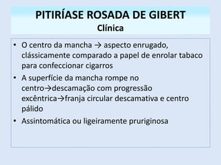 PITIRÍASE ROSADA DE GIBERT
Clínica
• O centro da mancha → aspecto enrugado,
clássicamente comparado a papel de enrolar tabaco
para confeccionar cigarros
• A superfície da mancha rompe no
centro→descamação com progressão
excêntrica→franja circular descamativa e centro
pálido
• Assintomática ou ligeiramente pruriginosa
 