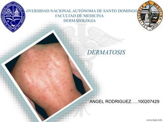 DERMATOSIS
ANGEL RODRIGUEZ…..100207429
UNIVERSIDAD NACIONAL AUTÓNOMA DE SANTO DOMINGO
FACULTAD DE MEDICINA
DERMATOLOGIA
 