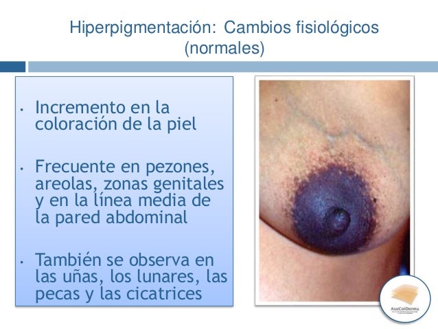 Como las casas librarse de las arrugas alrededor de los ojos en