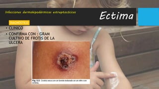 • CLINICO
• CONFIRMA CON : GRAM
CULTIVO DE FROTIS DE LA
ULCERA
Ectima
DIAGNÓSTICO
Infecciones dermohipodérmicas estreptocócicas
 