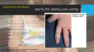 DACTILITIS AMPOLLOSA DISTAL
• SUPERFICIE DE LOS PULPEJOS
DE LOS DEDOS
• ESTREPTOCOCO DEL GRUPO A –
ESTAFILOCOCO AUREUS
• CUALQUIER DEDO DE LA MANO
O PIE
• AMPOLLA
• LA RESOLUCIÓN SE ACOMPAÑA
DE DESCAMACIÓN DEL PULPEJO
AFECTADO
DERMATOSIS BACTERIANA
Dermatología pediátrica. WILLIAM L. WESTON, MD. Cuarta edición
Saúl. Lecciones de Dermatología. 16 edición
 