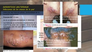 Foliculitis
DERMATOSIS BACTERIANA
Infecciones de los anexos de la piel
- Infección del folículo piloso, profundidad de la
invasión bacteriana
- Pústulas de 1-2 mm
- no es un proceso pruriginoso ni doloroso
- Las lesiones se extienden rápidamente en la
superficie, unas van curando, otras nuevas
aparecen; una vez que desaparecen no dejan
cicatriz.
estafilococos
Componente pilosebáceo: foliculitis y furunculosis,
Afectación glándulas sudoríparas apocrinas se
produce la hidrosadenitis.
Aglutinan el pelo, dificultando la rasurada
Son lesiones muy rebeldes al tratamiento
Límite de la implantación del pelo.
Coalecen y terminan formando
plastrones extensos.
 