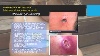 ANTRAX (CARBUNCO)
• CONSISTE EN UN FORÚNCULO
DE GRAN TAMAÑO O LA
CONFLUENCIA DE VARIOS DE
ELLOS.
• EL TRATAMIENTO CONSISTE
EN COMPRESAS HÚMEDAS Y
CALIENTES PARA FAVORECER
EL DRENAJE ESPONTÁNEO.
• USO DE ANTIBIÓTICOS
SISTÉMICOS.
• PUEDE SER NECESARIO EL
DRENAJE QUIRÚRGICO.
DERMATOSIS BACTERIANA
Infecciones de los anexos de la piel
 