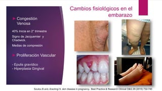 ►Congestión
Venosa
40% Inicia en 2° trimestre
Signo de Jacquemier y
Chadwick.
Medias de compresión
►Proliferación Vascular
- Epulis gravídico
- Hiperplasia Gingival
Cambios fisiológicos en el
embarazo
Soutou B and, Aractingi S. skin disease in pregnancy. Best Practice & Research Clinical O&G 29 (2015) 732-740
 