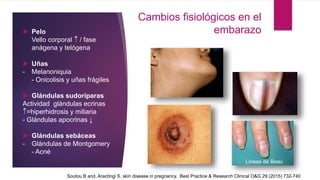 Cambios fisiológicos en el
embarazo► Pelo
Vello corporal  / fase
anágena y telógena
► Uñas
- Melanoniquia
- Onicolisis y uñas frágiles
► Glándulas sudoríparas
Actividad glándulas ecrinas
=hiperhidrosis y miliaria
- Glándulas apocrinas ↓
► Glándulas sebáceas
- Glándulas de Montgomery
- Acné
Soutou B and, Aractingi S. skin disease in pregnancy. Best Practice & Research Clinical O&G 29 (2015) 732-740
Líneas de Beau
 
