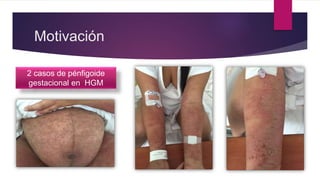 Motivación
2 casos de pénfigoide
gestacional en HGM
 