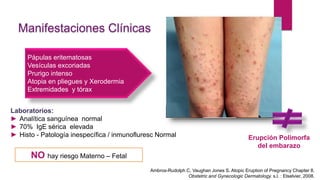 Manifestaciones Clínicas
Pápulas eritematosas
Vesículas excoriadas
Prurigo intenso
Atopia en pliegues y Xerodermia
Extremidades y tórax
Laboratorios:
► Analítica sanguínea normal
► 70% IgE sérica elevada
► Histo - Patología inespecífica / inmunofluresc Normal Erupción Polimorfa
del embarazo
NO hay riesgo Materno – Fetal
Ambros-Rudolph C, Vaughan Jones S. Atopic Eruption of Pregnancy Chapter 8.
Obstetric and Gynecologic Dermatology. s.l. : Elselvier, 2008.
 