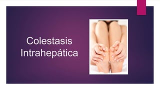 Colestasis
Intrahepática
 