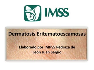 Dermatosis Eritematoescamosas 
Elaborado por: MPSS Pedraza de 
León Juan Sergio 
 