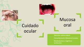 Cuidado
ocular
Mucosa
oral
Solución salina estéril
Cloranfenicol o Glucocorticoides
Metilcelulosa o lagrimas
artificiales
 