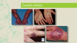 Cuadro clínico
 
