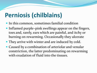 Perniosis (chilblains)
 In this common, sometimes familial condition
 Inflamed purple–pink swellings appear on the fingers,
toes and, rarely, ears which are painful, and itchy or
burning on rewarming. Occasionally they ulcerate
 They arrive with winter and are induced by cold.
 Caused by a combination of arteriolar and venular
constriction, the latter predominating on rewarming
with exudation of fluid into the tissues.
 
