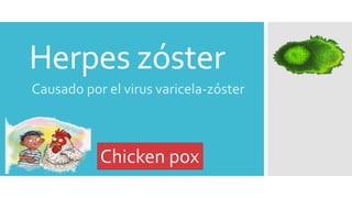 Herpes zóster
Causado por el virus varicela-zóster
Chicken pox
 