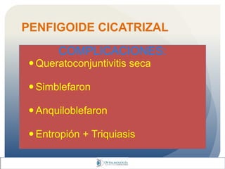 PENFIGOIDE CICATRIZAL
COMPLICACIONES:
 Queratoconjuntivitis seca
 Simblefaron
 Anquiloblefaron
 Entropión + Triquiasis
 