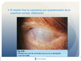  El estadio final se caracteriza por queratinización de la
superficie corneal, obliteración
 