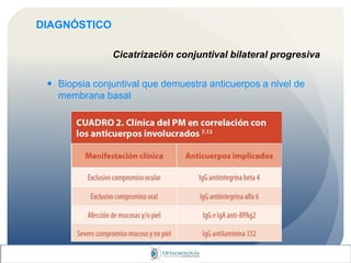 DIAGNÓSTICO
Cicatrización conjuntival bilateral progresiva
 Biopsia conjuntival que demuestra anticuerpos a nivel de
membrana basal
 