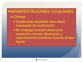 MANIFESTACIONES OCULARES
 Córnea
 Usualmente respetada salvo fases
avanzadas de cicatrización
 Sin embargo pueden observarse
ulceración corneal, desecación y
vascularización periférica durante la fase
aguda
 