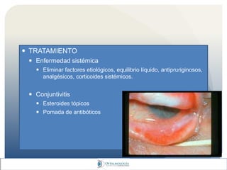  TRATAMIENTO
 Enfermedad sistémica
 Eliminar factores etiológicos, equilibrio líquido, antipruriginosos,
analgésicos, corticoides sistémicos.
 Conjuntivitis
 Esteroides tópicos
 Pomada de antibóticos
 