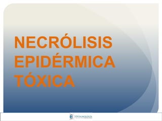 NECRÓLISIS
EPIDÉRMICA
TÓXICA
 