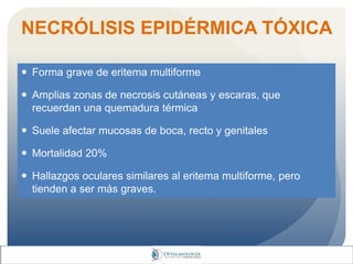 NECRÓLISIS EPIDÉRMICA TÓXICA
 Forma grave de eritema multiforme
 Amplias zonas de necrosis cutáneas y escaras, que
recuerdan una quemadura térmica
 Suele afectar mucosas de boca, recto y genitales
 Mortalidad 20%
 Hallazgos oculares similares al eritema multiforme, pero
tienden a ser más graves.
 