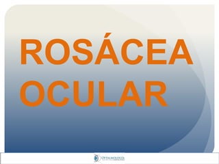 ROSÁCEA
OCULAR
 