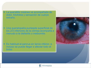  La queratitis rosácea va acompañada de
dolor, fotofobia y sensación de cuerpo
extraño.
 Una queratopatía punteada superficial de
los 2/3 inferiores de la córnea acompaña a
menudo a la blefaritis o meibomitis
 Es habitual el pannus en tercio inferior, e
incluso se puede llegar a afectar todo el
limbo
 