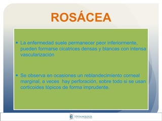 ROSÁCEA
 La enfermedad suele permanecer peor inferiormente,
pueden formarse cicatrices densas y blancas con intensa
vascularización
 Se observa en ocasiones un reblandecimiento corneal
marginal, a veces hay perforación, sobre todo si se usan
corticoides tópicos de forma imprudente.
 