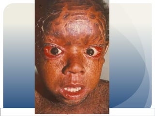 Dermatosis y sus conjuntivitis 2015