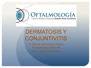 DERMATOSIS Y
CONJUNTIVITIS
Dr. Alán de Jesús Gaytán Lorenzo
R1 Oftalmología UMAE 189
C.M.N. Adolfo Ruiz Cortines
 