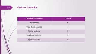 38 Oedema Formation
Oedema Formation Grades
No oedema 0
Very slight oedema 1
Slight oedema 2
Moderate oedema 3
Severe oedema 4
 