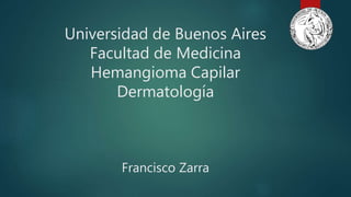 Universidad de Buenos Aires
Facultad de Medicina
Hemangioma Capilar
Dermatología
Francisco Zarra
 