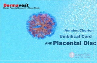 AND Placental Disc
Umbilical Cord
Amnion/Chorion
Dermavest
®
Human Placental Connective Tissue Matrix
 