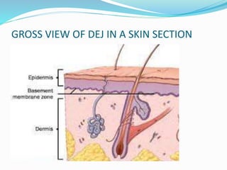GROSS VIEW OF DEJ IN A SKIN SECTION
 