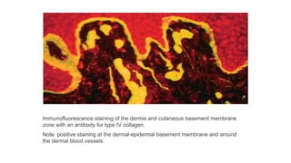 DERMO EPIDERMAL JUNCTION. Various components of basement membrane zone ...