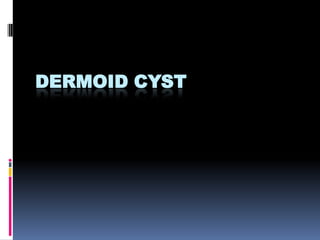 DERMOID CYST
 