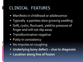 CLINICAL FEATURES
 Manifests in childhood or adolescence
 Typically a painless slow growing swelling
 Soft, cystic, fluctuant, yield to pressure of
    finger and will not slip away
   Transillumination negative
   Putty in consistency
   No impulse on coughing
   Underlying bony defect – clue to diagnosis
   Location along line of fusion
 