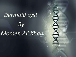 Dermoid cyst
By
Momen Ali Khan