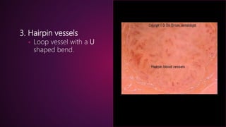 Dermoscopy an overview | PPTX