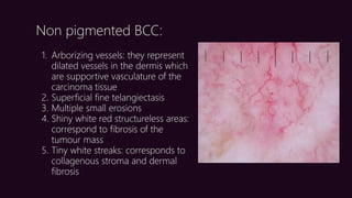 Arborizing Dermoscopy an overview | PPTX