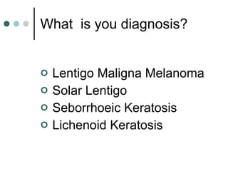 What  is you diagnosis? Lentigo Maligna Melanoma Solar Lentigo Seborrhoeic Keratosis Lichenoid Keratosis 