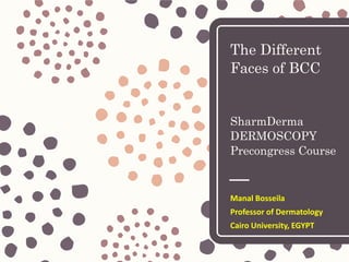 The Different
Faces of BCC
SharmDerma
DERMOSCOPY
Precongress Course
Manal Bosseila
Professor of Dermatology
Cairo University, EGYPT
 
