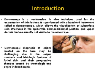 Comprehensive Dermoscopy of Facial Skin Lesions: Diagnosis and Patterns ...