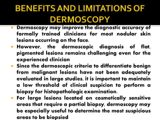 Comprehensive Dermoscopy of Facial Skin Lesions: Diagnosis and Patterns ...