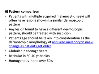 ii) Pattern comparison
• Patients with multiple acquired melanocytic naevi will
often have lesions showing a similar dermoscopic
pattern
• Any lesion found to have a different dermoscopic
pattern, should be treated with suspicion.
• Patients age should be taken into consideration as the
dermoscopic morphology of acquired melanocytic naevi
change as patients get older
• Globular in teenage years
• Reticular in 30-40 year olds
• Homogenous in the over 50’s

 