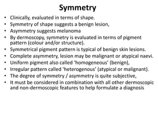 Symmetry
•
•
•
•
•
•
•
•
•
•

Clinically, evaluated in terms of shape.
Symmetry of shape suggests a benign lesion,
Asymmetry suggests melanoma
By dermoscopy, symmetry is evaluated in terms of pigment
pattern (colour and/or structure).
Symmetrical pigment pattern is typical of benign skin lesions.
Complete asymmetry, lesion may be malignant or atypical naevi.
Uniform pigment also called ‘homogeneous’ (benign),
Irregular pattern called ‘heterogenous’ (atypical or malignant).
The degree of symmetry / asymmetry is quite subjective,
It must be considered in combination with all other dermoscopic
and non-dermoscopic features to help formulate a diagnosis

 