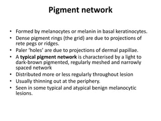 Pigment network
• Formed by melanocytes or melanin in basal keratinocytes.
• Dense pigment rings (the grid) are due to projections of
rete pegs or ridges.
• Paler ‘holes’ are due to projections of dermal papillae.
• A typical pigment network is characterised by a light to
dark-brown pigmented, regularly meshed and narrowly
spaced network
• Distributed more or less regularly throughout lesion
• Usually thinning out at the periphery.
• Seen in some typical and atypical benign melanocytic
lesions.

 