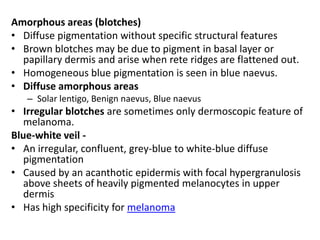 Amorphous areas (blotches)
• Diffuse pigmentation without specific structural features
• Brown blotches may be due to pigment in basal layer or
papillary dermis and arise when rete ridges are flattened out.
• Homogeneous blue pigmentation is seen in blue naevus.
• Diffuse amorphous areas
– Solar lentigo, Benign naevus, Blue naevus

• Irregular blotches are sometimes only dermoscopic feature of
melanoma.
Blue-white veil • An irregular, confluent, grey-blue to white-blue diffuse
pigmentation
• Caused by an acanthotic epidermis with focal hypergranulosis
above sheets of heavily pigmented melanocytes in upper
dermis
• Has high specificity for melanoma

 