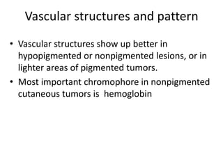Vascular structures and pattern
• Vascular structures show up better in
hypopigmented or nonpigmented lesions, or in
lighter areas of pigmented tumors.
• Most important chromophore in nonpigmented
cutaneous tumors is hemoglobin

 