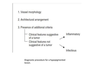 Diagnostic procedure for a hypopigmented
lesion.

 