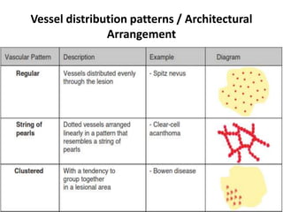 Vessel distribution patterns / Architectural
Arrangement

 